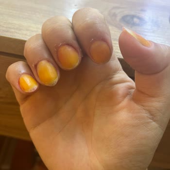 Gratis'ten Aldığım Flormar Marka Oje Tırnaklarıma Zarar Verdi