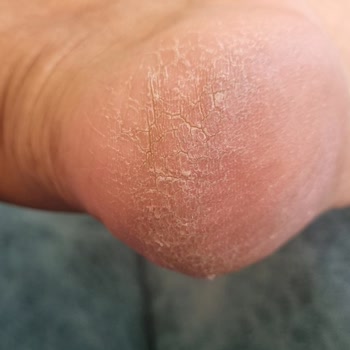 Mersin Sayapark Şubesi Pedikür Hizmetinden Memnun Kalmadım