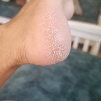 Mersin Sayapark Şubesi Pedikür Hizmetinden Memnun Kalmadım