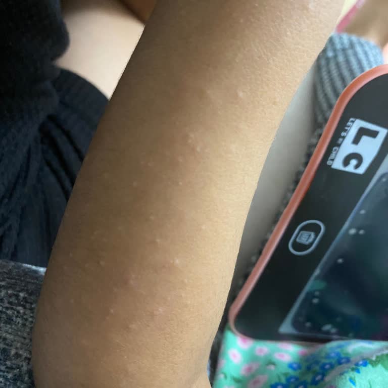 Elbistan Devlet Hastanesi'nde Çocuk Doktoru Randevu Sorunu Ve Tedavi Mağduriyeti