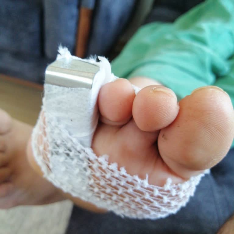 Yanlış Teşhis Ve Yetersiz Tedavi Sonucu Mağduriyet