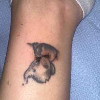 Lazer Epilasyon Sonrası Dövmem Yandı, Para İadem Yapılmadı!