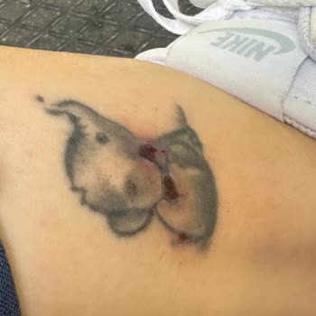 Lazer Epilasyon Sonrası Dövmem Yandı, Para İadem Yapılmadı!