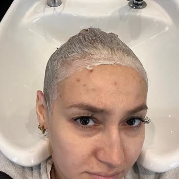 Yanlış Renk Saç Boyası Nedeniyle Sağlık Ve Maddi Mağduriyet