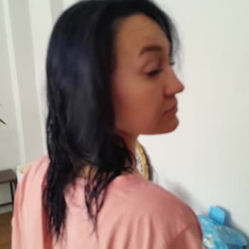 Yanlış Renk Saç Boyası Nedeniyle Sağlık Ve Maddi Mağduriyet