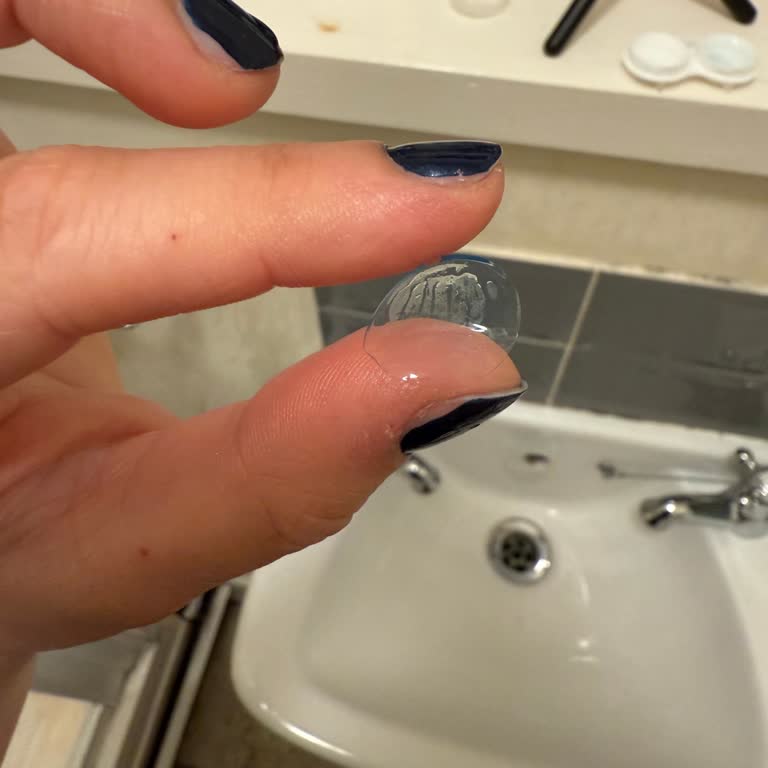 Ultra Contact Lenslerde Beklenmedik Sorunlar Ve Görüş Kaybı Yaşadım