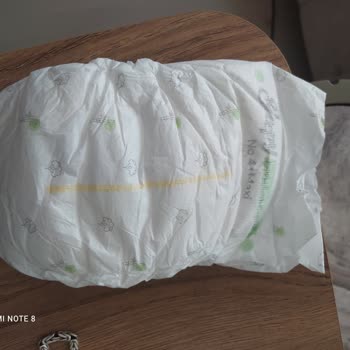 Sleepy Bebek Bezi Orijinalliği Ve Kalite Sorunu Mağduriyet Yaşatıyor