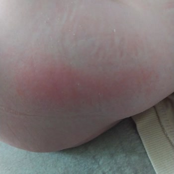 Sleepy Bebek Bezi Orijinalliği Ve Kalite Sorunu Mağduriyet Yaşatıyor