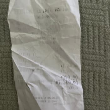 Hifu İşlemi Sonrası Gıdı Bölgemde Artış Yaşadım Sonuç Alamadım