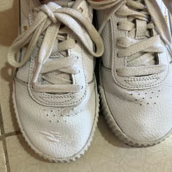 Ayakkabı Tabanı Şişti, Yanlarda Açılma Oluştu