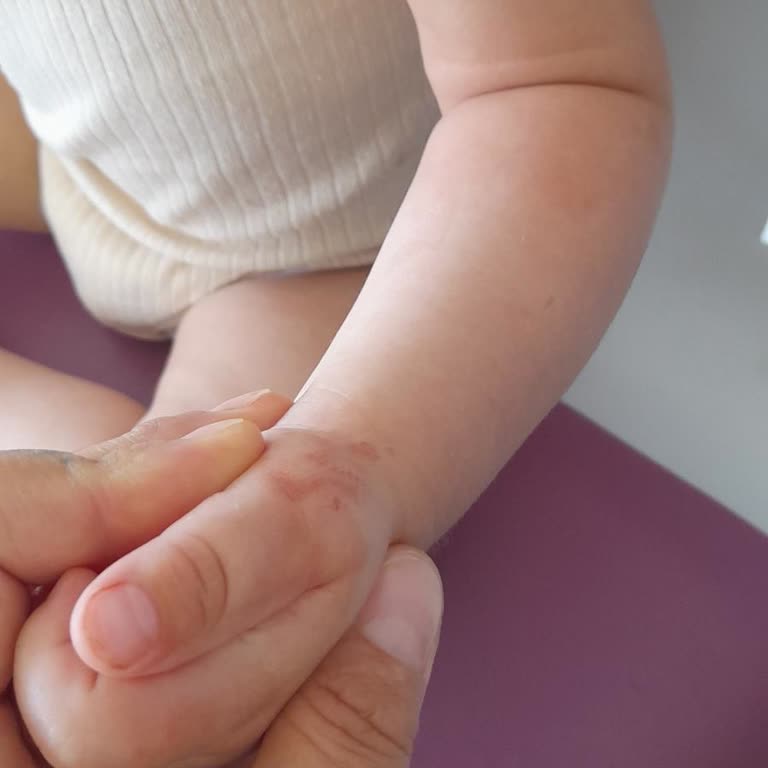 Oğlumun Kan Alımı Sırasında Yaşadığımız Büyük Mağduriyet