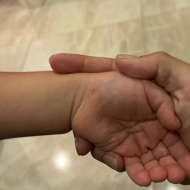 Basit Kıymık Çıkarma İşlemine Yüksek Fatura Şoku Memorial Ataşehir'de