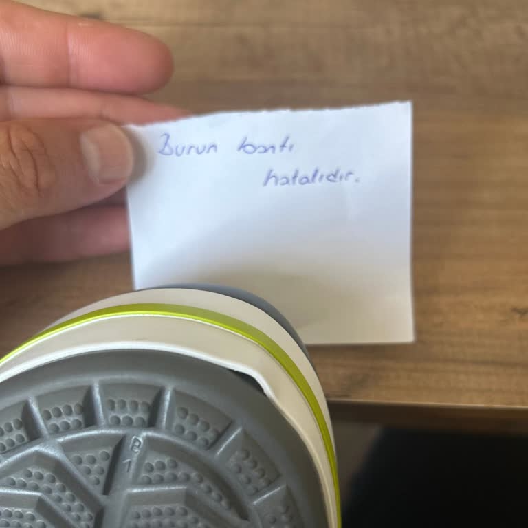 A101den Alınan Crocs Terlikler Defolu Ve Sorunlu Çıktı