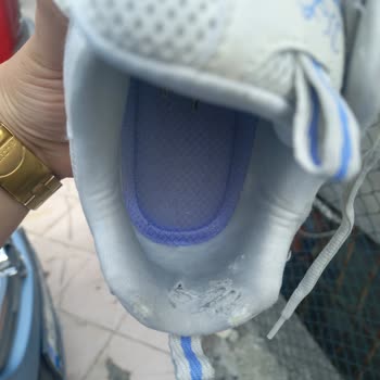 Skechers Ayakkabıda Kısa Sürede Yaşanan Deformasyon Ve Mağduriyet