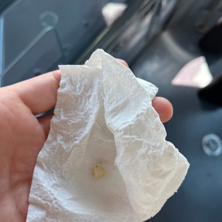 İmplant Tedavisinde Sürekli Sorun Ve Memnuniyetsizlik