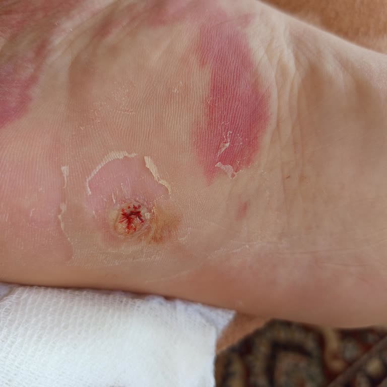 Ciddi Ayak Yaralanmasına Rağmen Rapor Yazılmadı