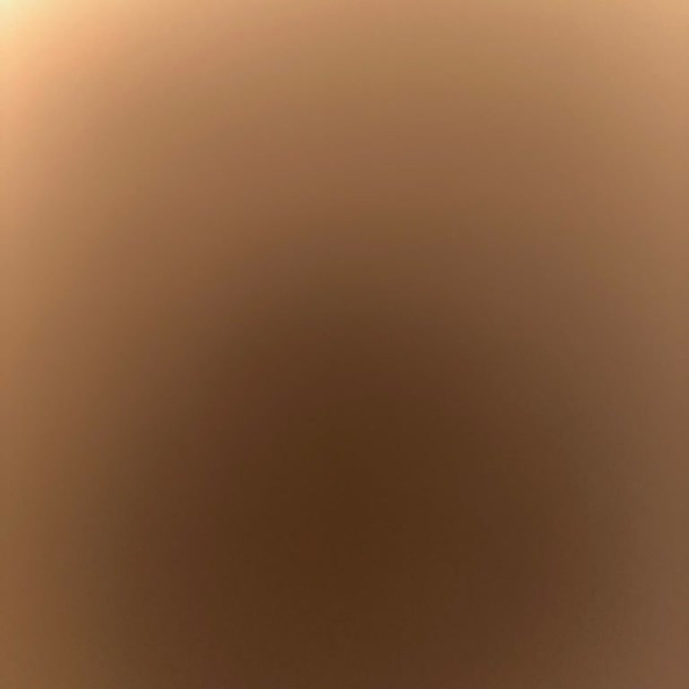 Doğum Sonrası İlgi Azaldı Ve Fatura Verilmedi