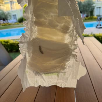 Çocuk Bezinden Çıkan Yabancı Madde Şoku