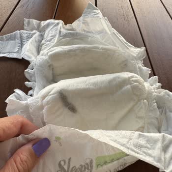 Çocuk Bezinden Çıkan Yabancı Madde Şoku