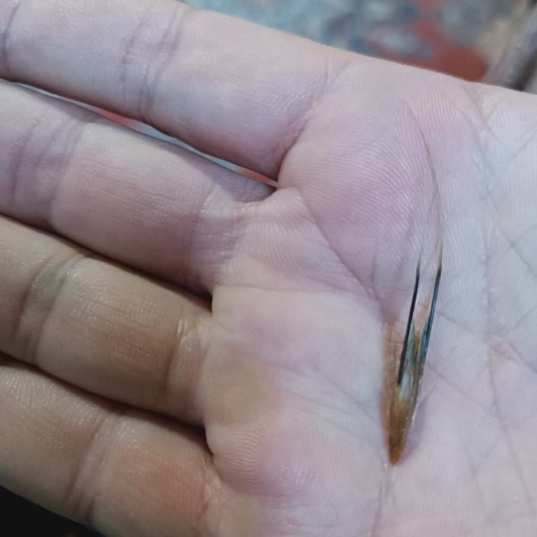 Dürümden Çıkan Sert Bitki Ve İlgisiz Müşteri Hizmeti Mağduriyeti