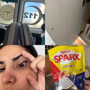 Bulaşık Tableti Patladı, Gözüm Zarar Gördü Sağlık Riski Yaşadım