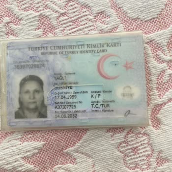 Ajet Uçuşunda Kırılan Valiz İçin Mağduriyet Ve Yetersiz Çözüm