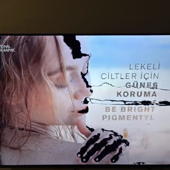 D-Smart Tv Arızasında Yetersiz Destek Ve Yüksek Servis Ücreti