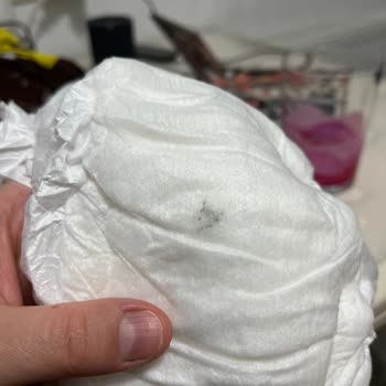 Bebek Bezinde Küf Şoku: Sağlık Riski Göz Ardı Edilemez