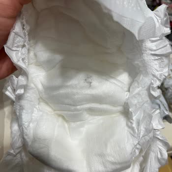 Bebek Bezinde Küf Şoku: Sağlık Riski Göz Ardı Edilemez