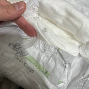 Bebek Bezinde Küf Şoku: Sağlık Riski Göz Ardı Edilemez