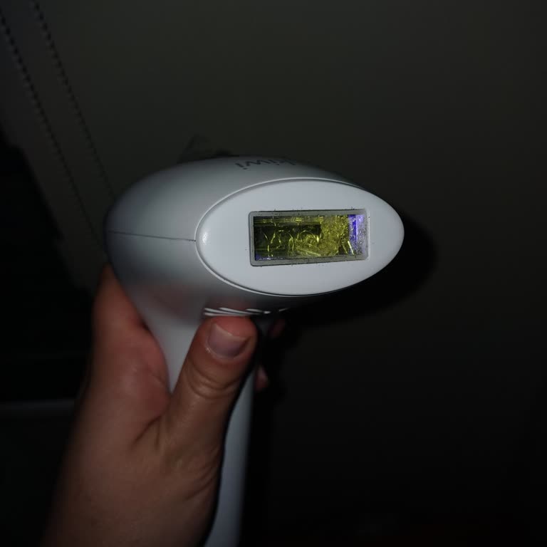 Lazer Cihazı Patladı, Müşteri Hizmetlerine Ulaşamıyorum