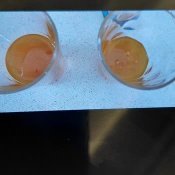 Argivit Şurup İçinde Parçacıklar Ve Çocukta Sağlık Sorunları