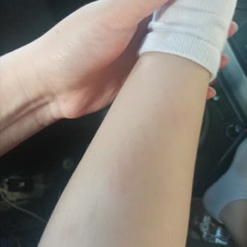 Ikea Smaland Oyun Alanında Çocuğuma Zarar Verildi, İlgisiz Davranıldı