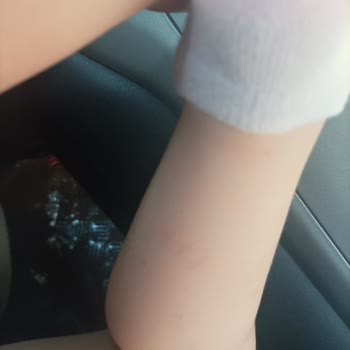 Ikea Smaland Oyun Alanında Çocuğuma Zarar Verildi, İlgisiz Davranıldı