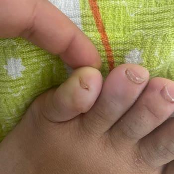 Deichmann’dan Aldığım Ayakkabı Ayağımı Yaraladı, İade Talebim Reddedildi