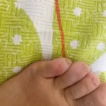 Deichmann’dan Aldığım Ayakkabı Ayağımı Yaraladı, İade Talebim Reddedildi