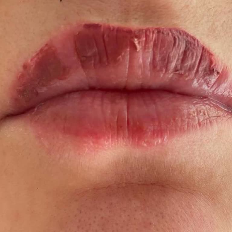 Güzellik Hizmetlerinde Yaşanan Sağlık Sorunları ve İletişim Problemleri