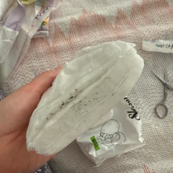 Sleepy Islak Mendilde Küf Şoku, Bebeğime Zarar Verdi Mi Endişeliyim