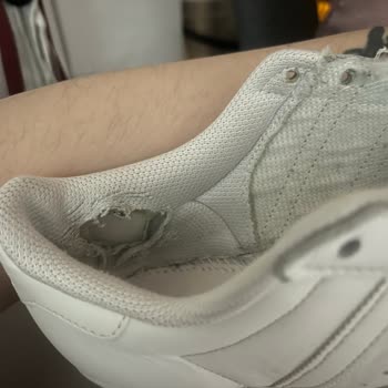 Adidas Superstar Ayakkabıda Kalite Sorunu Ve Garanti Sürecinde Hayal Kırıklığı