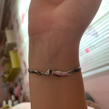 Fenerium Bileklikler Kısa Sürede Parçalandı, Mağduriyet Yaşadık