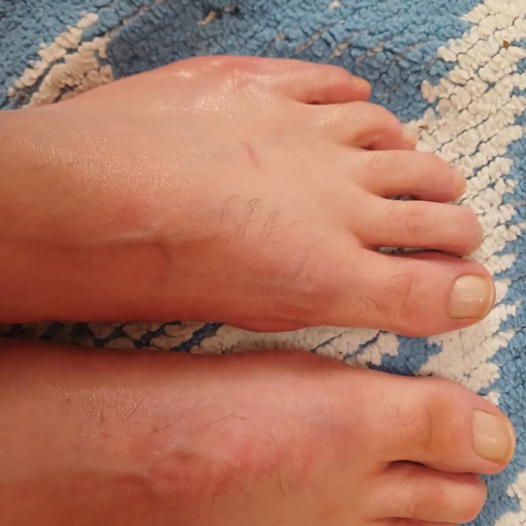 Lumberjack Ayakkabı Özel Tabanlıkla Kullanılamıyor, Değişim Reddedildi