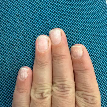 Olga Tırnak Center Beklenmedik Hizmet Ve Ücret Problemi!