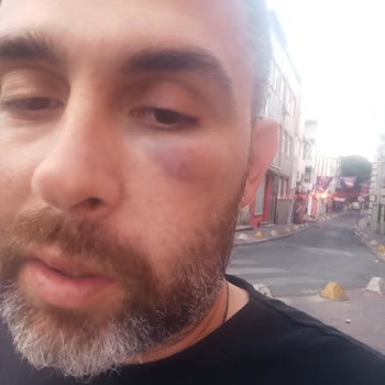 Benzinlikte Müşteriye Hakaret Ve Fiziksel Şiddet