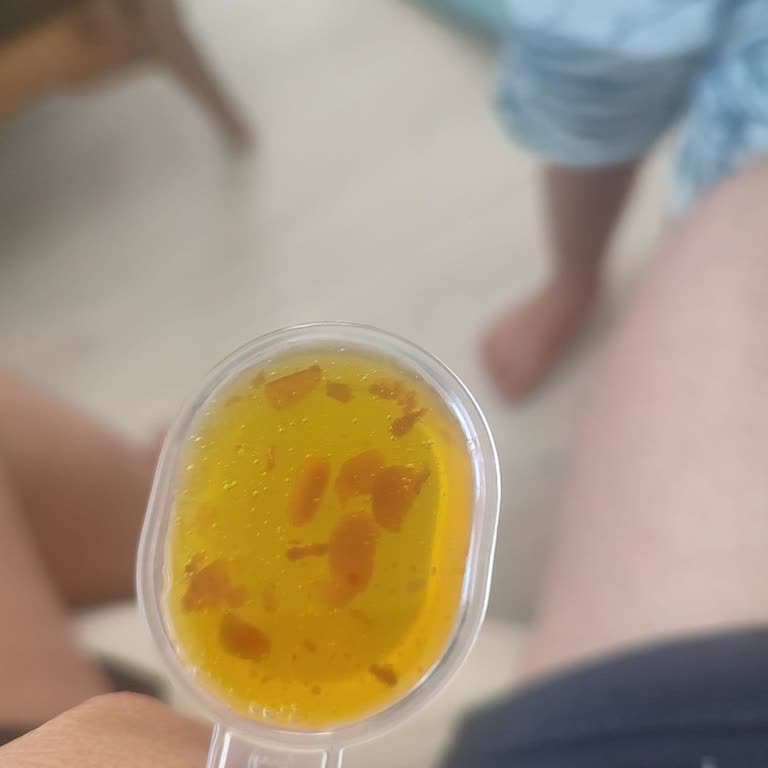 Şurup Şişesinde Oluşan Tortular Ve Tadında Bozukluk Endişesi