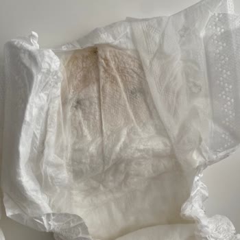 Sleepy Bebek Bezinde Hijyen Şüphesi Ve Leke Problemi