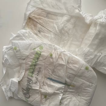 Sleepy Bebek Bezinde Hijyen Şüphesi Ve Leke Problemi