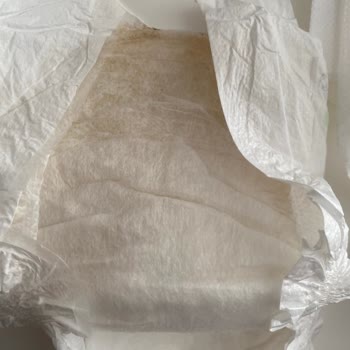 Sleepy Bebek Bezinde Hijyen Şüphesi Ve Leke Problemi