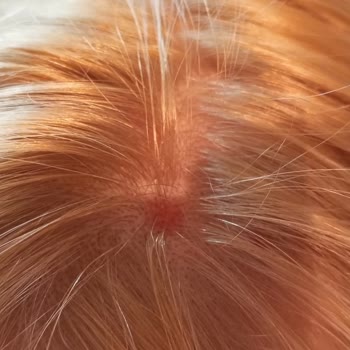 Palette Saç Boyası Saç Derimde Yanma Ve Su Toplamasına Neden Oldu