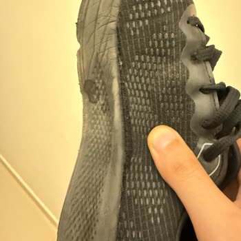 Garanti Kapsamındaki Skechers Ayakkabımda Ciddi Deformasyon Ve Servis Reddi