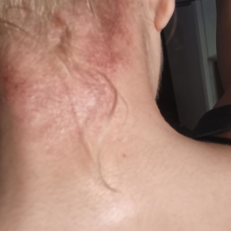 Saç Boyası Kutusunda Yanlış Ürün Yüzünden Saçlarım Mavi Siyaha Döndü